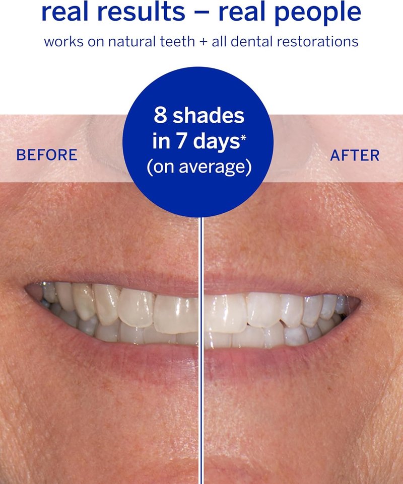 Supersmile Whitening System - Toothpaste & Accelerator Duo with 14 Dissolving Whitening Strips | Travel Size Kits