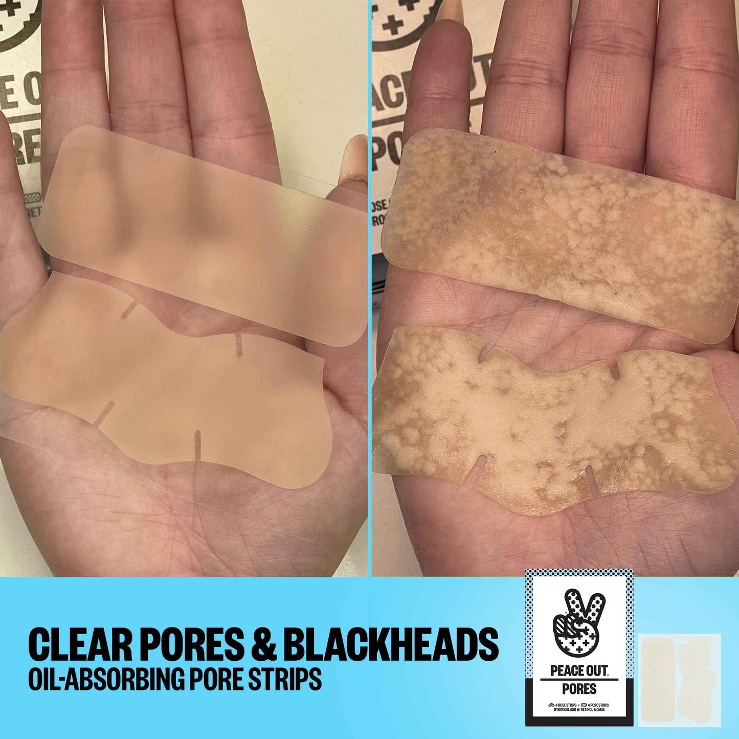 PEACE OUT Skincare Pore Minimizing Strips, Hydrocolloid Pore-Refining Nose and Face Strips with Retinol & Vitamin A to Shrink Enlarged Pores and Remove Blackheads (4 pore and 4 nose strips)