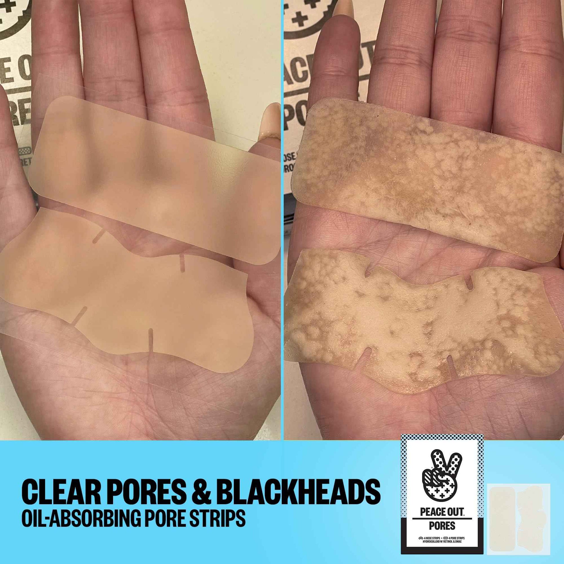 PEACE OUT Skincare Pore Minimizing Strips, Hydrocolloid Pore-Refining Nose and Face Strips with Retinol & Vitamin A to Shrink Enlarged Pores and Remove Blackheads (4 pore and 4 nose strips)
