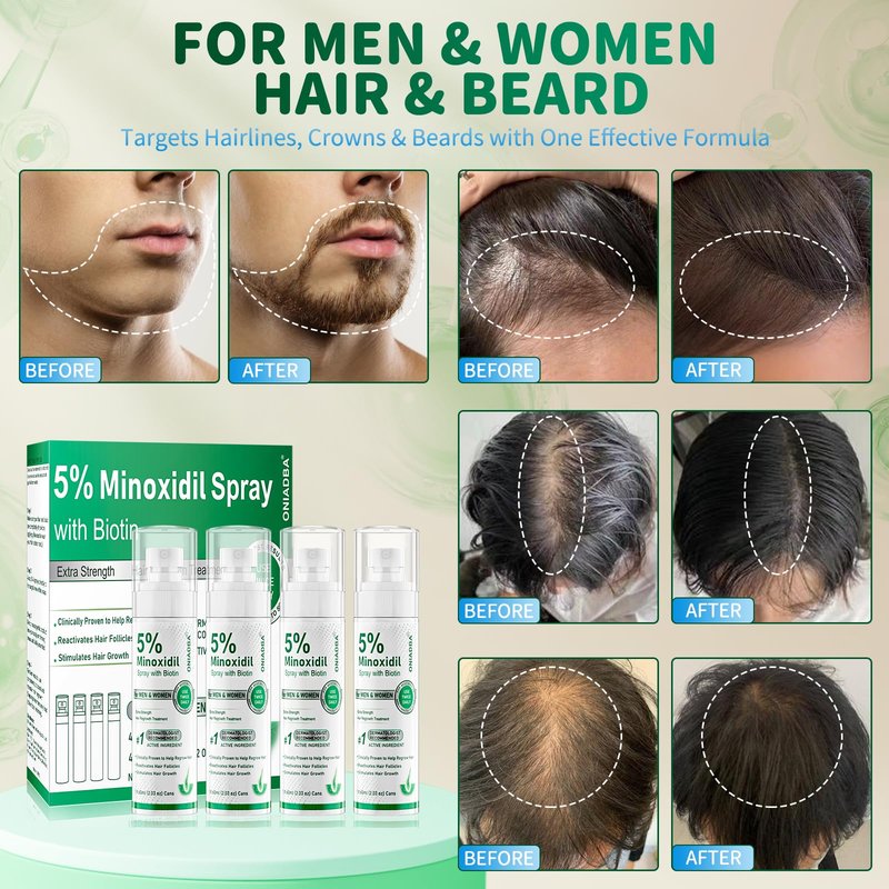 5% Minoxidil Spray for Hair Growth, 4 Pack (8.12oz), For Men & Women – Extra Strength Hair Regrowth Treatment with Biotin & Castor Oil, Supports Thicker Fuller Hair & Beard, Non-Greasy 4-Month Supply