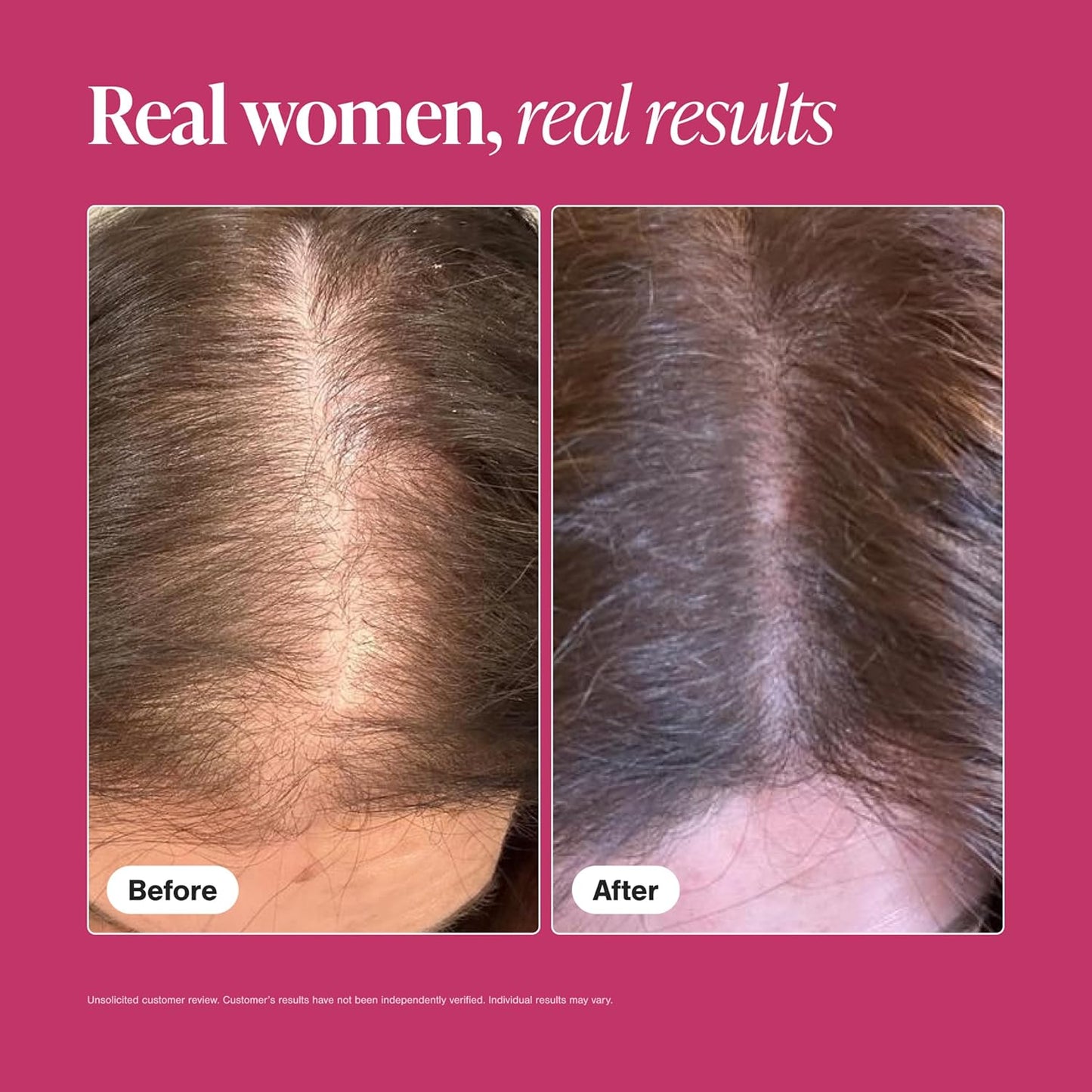 Viviscal Hair Growth Supplements for Women - Thicker, Fuller Hair with Collagen Complex | 60 Tablets, 1 Month Supply