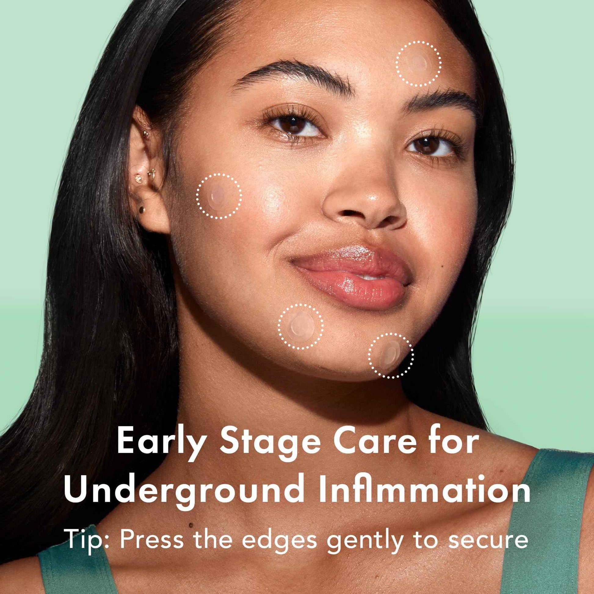 Rael Pimple Patches, Invisible & Microcrystal Spot Cover - Hydrocolloid Acne Pimple Patch for Face, Zit and Blemish, Breakouts, Korean Skin Care (33 Count)