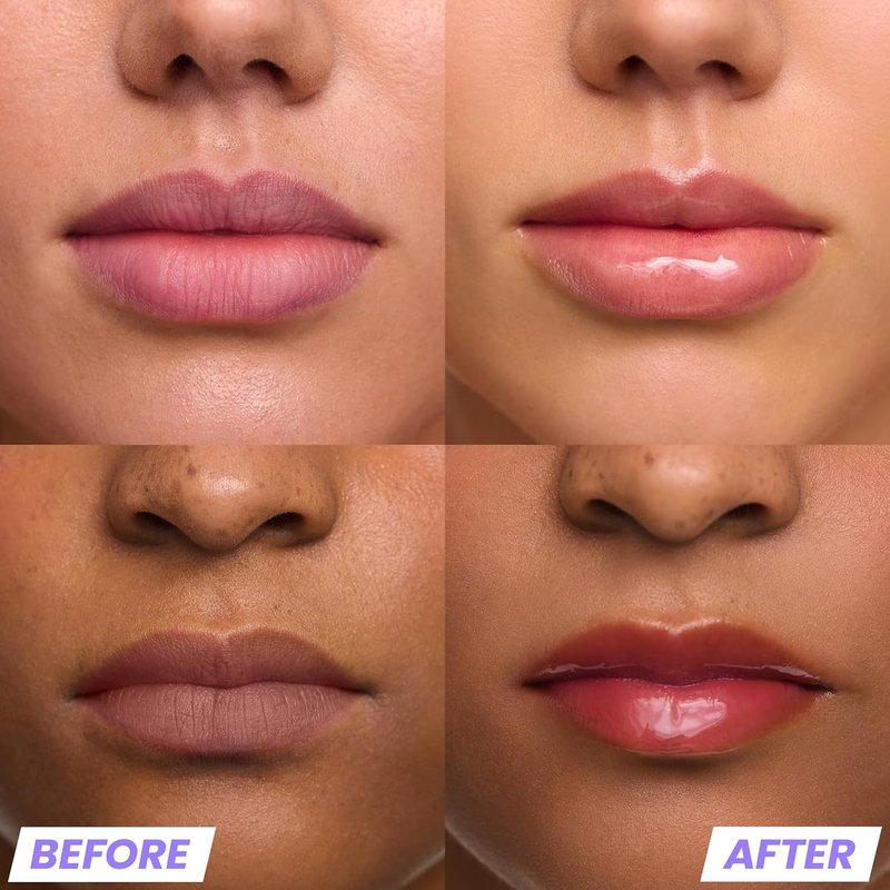 Wonderskin Lip Gloss - Hydrating Clear Glitter Lip Gloss | High Shine Finish for Luscious Lips