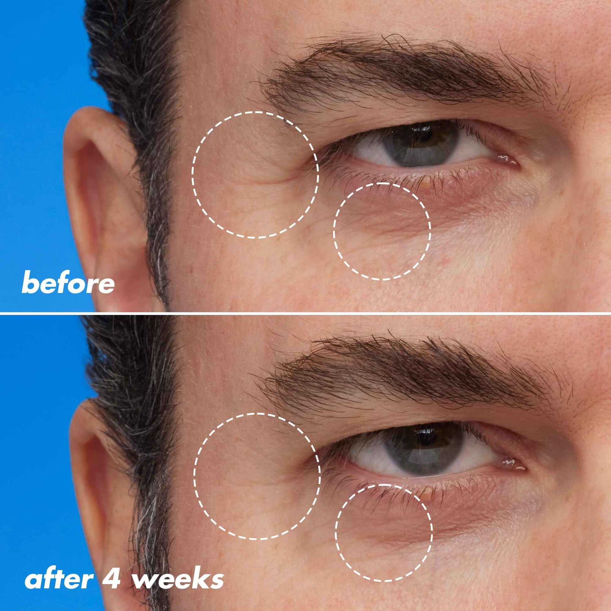 e.l.f. SKIN Youth Boosting Blue-ty Sleep Night Oil, Gentle Overnight Face Oil, Treats Fine Lines & Uneven Texture, Lightweight, Vegan & Cruelty-Free