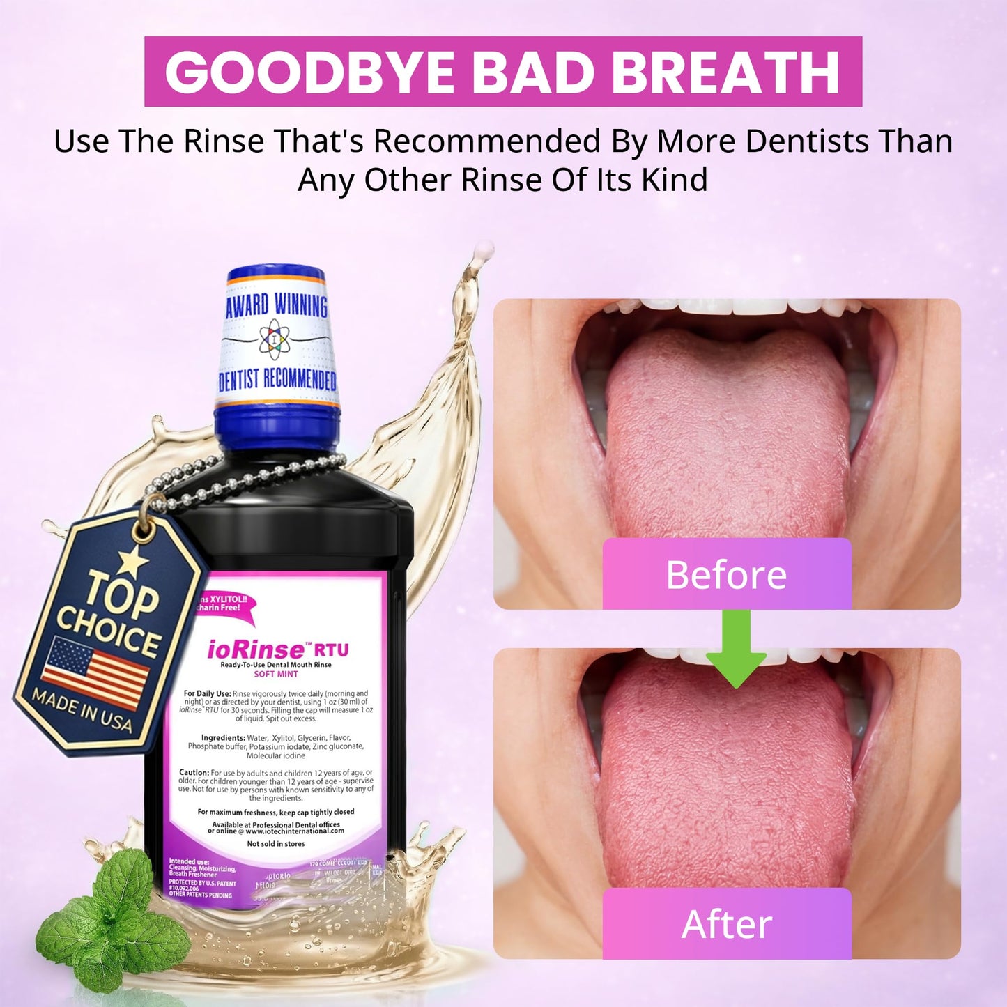 ioRinse RTU Halitosis Mouthwash for Fresh Breath, Dentists' Top Choice, Alcohol Free & Fluoride Free Molecular Iodine Oral Rinse, Soft Mint, Professional Clean Mouth Wash, RTU Mouthwash 33.8 oz