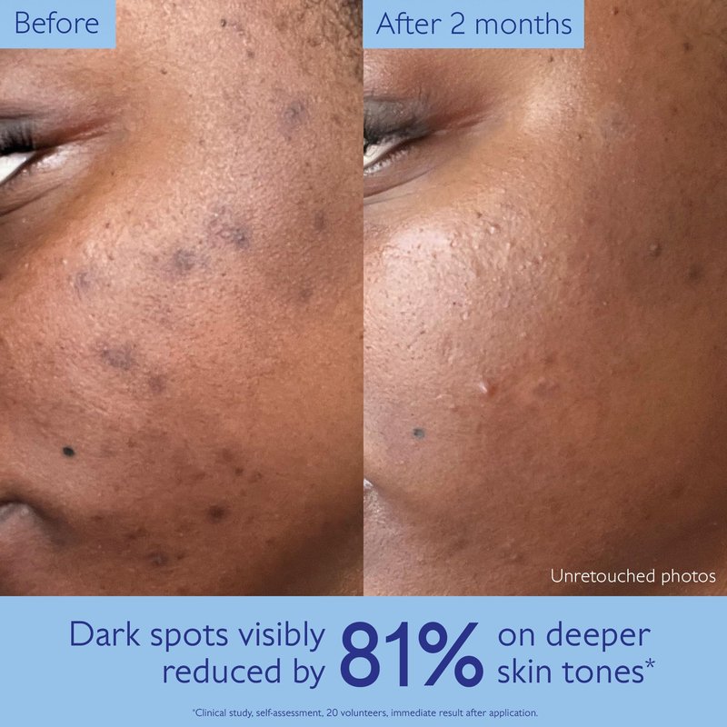 Caudalie Vinoperfect Brightening Dark Spot Serum Vitamin C Alternative - 62x More Effective than Vitamin C with Viniferine for a Visibly Brighter Even Complexion, 30 mL