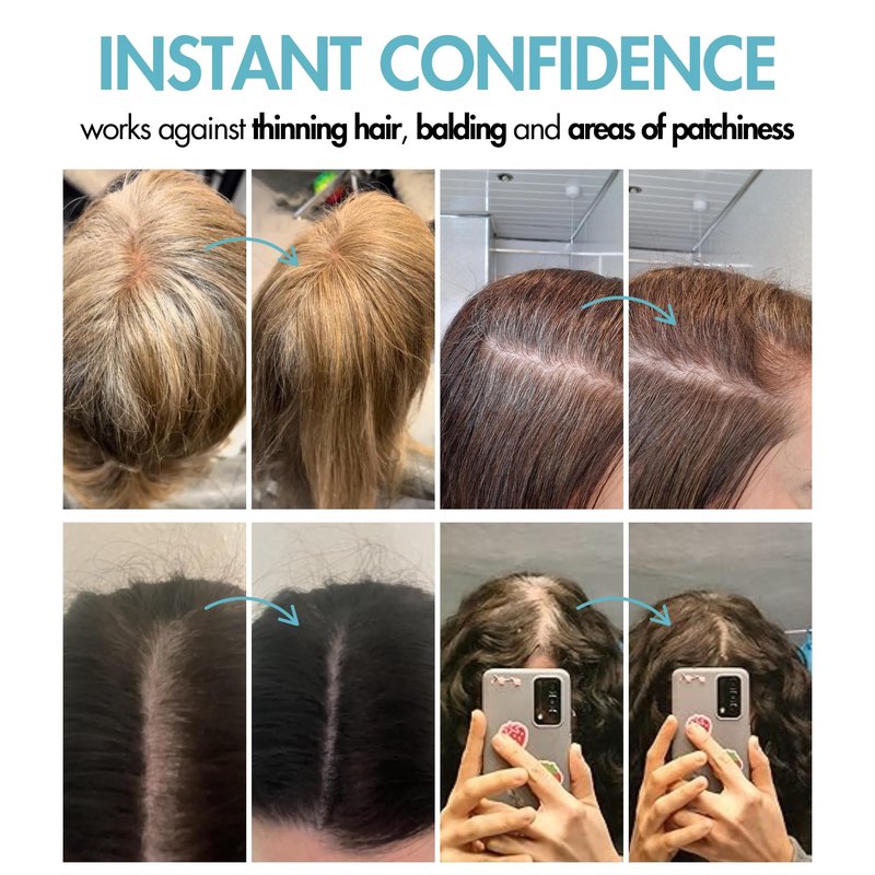 Hair Genetics Root Cover Up Hide Your Grey Hairs Roots NEW Mineral Powder Technology Natural looking Results in Seconds Root Touch Up Powder (Dark Brown)