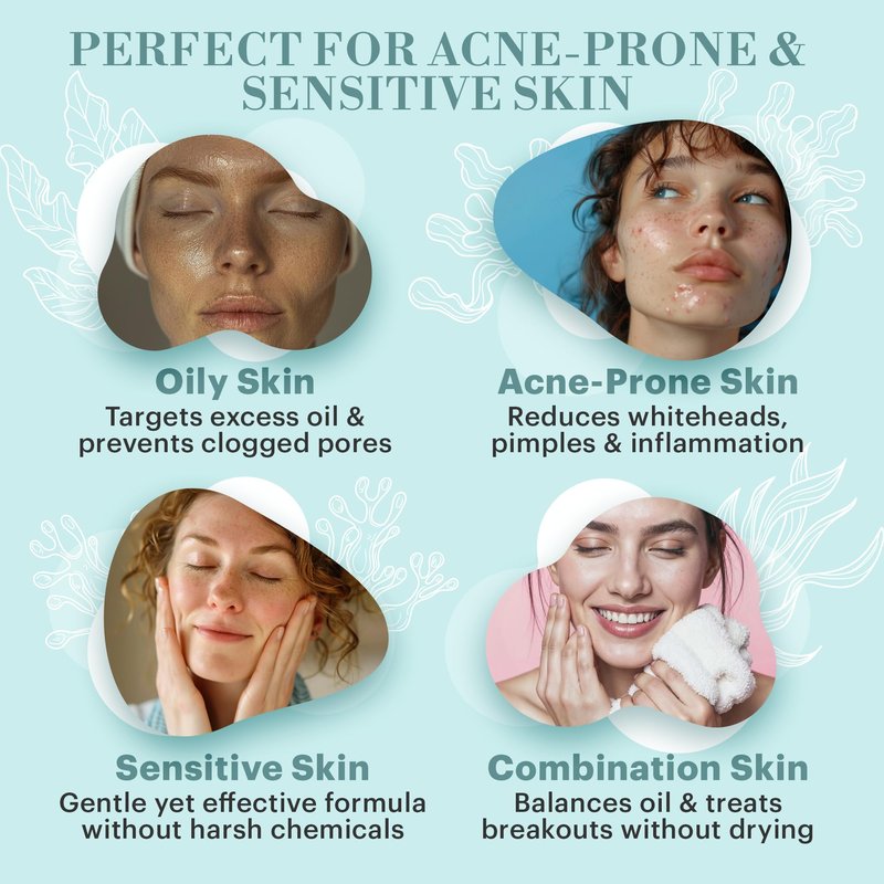 Repechage Hydra Medic Drying Lotion Targeted Treatment (0.25 fl oz / 7.5 mL) – Salicylic Acid & Fruit Acid – Overnight Blemish Solution with Mulberry, Licorice & Kojic Acid – Pro-Grade Skincare