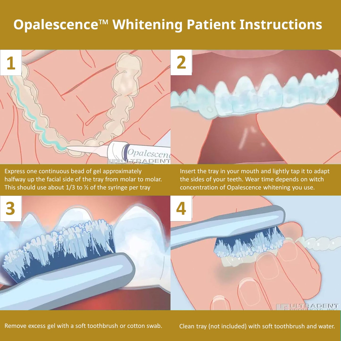 Opalescence 45% Syringes Teeth Whitening Gel with PF - 5359-2T