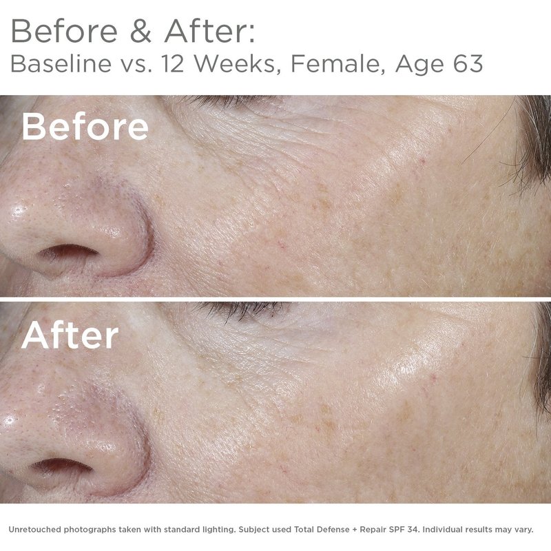 SkinMedica Total Defense + Repair SPF 34 Tinted Sunscreen for Face. This Lightweight, Facial Sunscreen is Ideal for Oily and/or Combination Skin, 2.3 Oz
