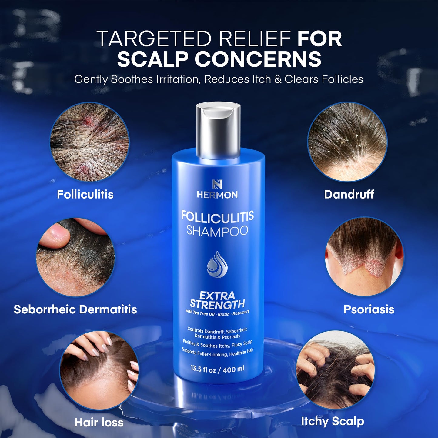 Hermon Folliculitis Treatment (2 Packs Folliculitis Shampoo)