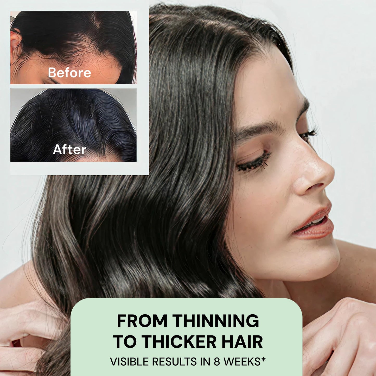 YBERA VELLO SERUM FOR THINNING HAIR with Advanced Technology ALFA-LACTOBABY, Scalp Serum for Hair Growth, Anti Hair Loss, Hair Regrowth for Men and Women, 90ML