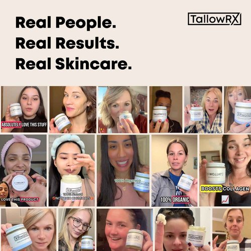 TALLOWRX Tallow Body Lotion – 100% Grass-Fed Beef Tallow for Skin, Face & Body – Pure & Organic Moisturizer with Jojoba Oil, Vitamin E (8 Fl Oz, Vanilla)