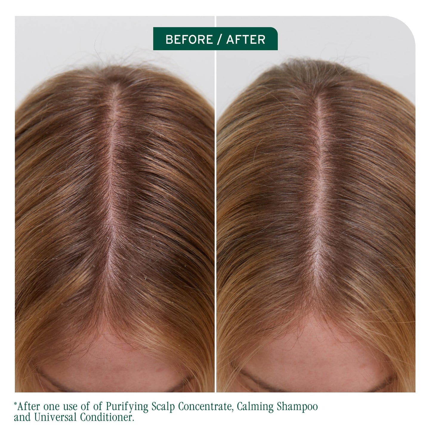 Biolage Scalp Sync Universal Conditioner - Nourishing & Hydrating for All Scalp Types, Lightweight Moisturizing & Conditioning, Fermented Tea Blend & Glycolic Acid, Vegan & Paraben-Free, 7.9 Fl Oz