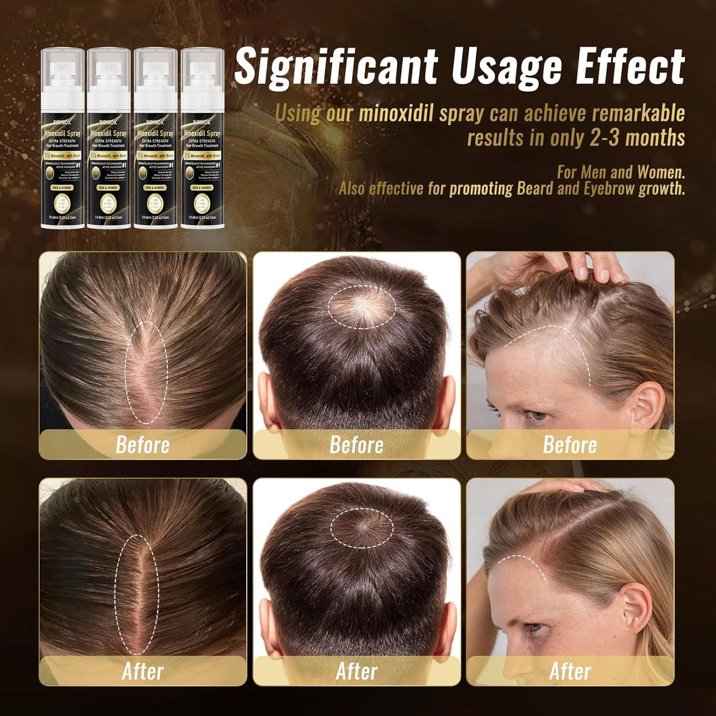 Minoxidil Spray for Hair Growth - Extra Strength 5% Formula with Biotin & Castor Oil | 4-Month Supply (4 Pack, 8.12 oz)