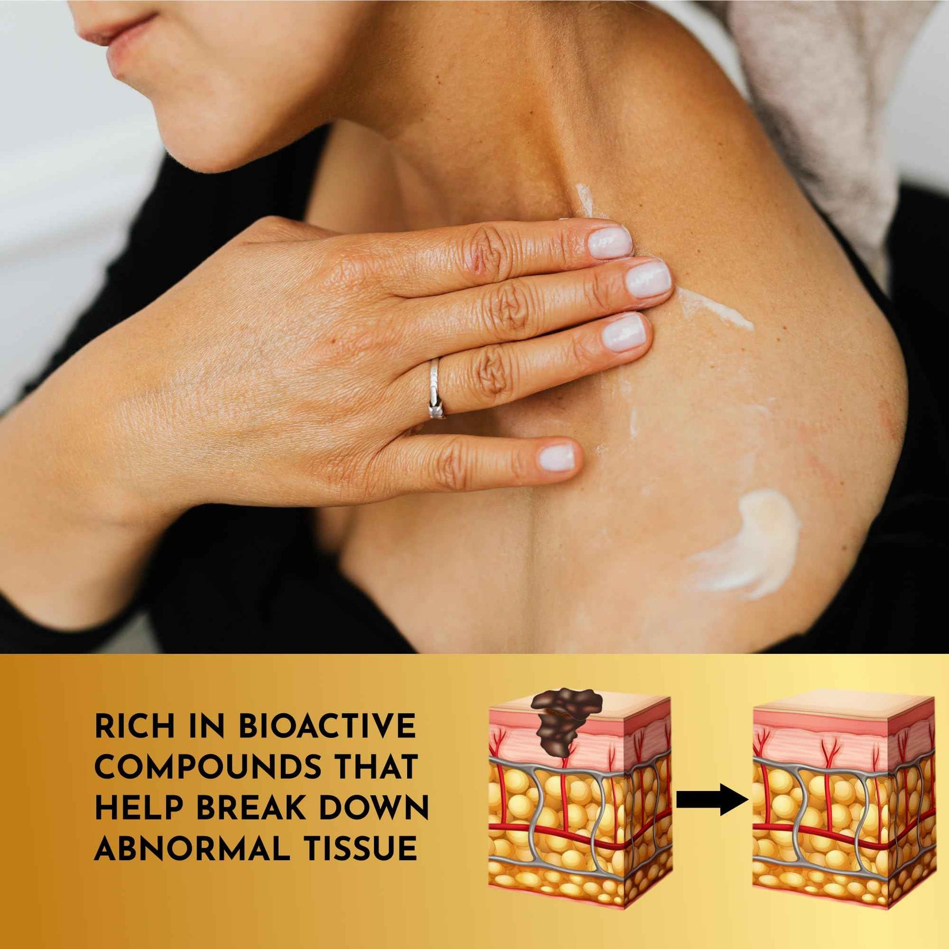 Layla Mae Bee Venom Skin Treatment Cream - Wrinkle Care Face Lift & Firming Muscle & Joint Wellness Body Pain Support Cream - Natural Care for Skin Imperfection