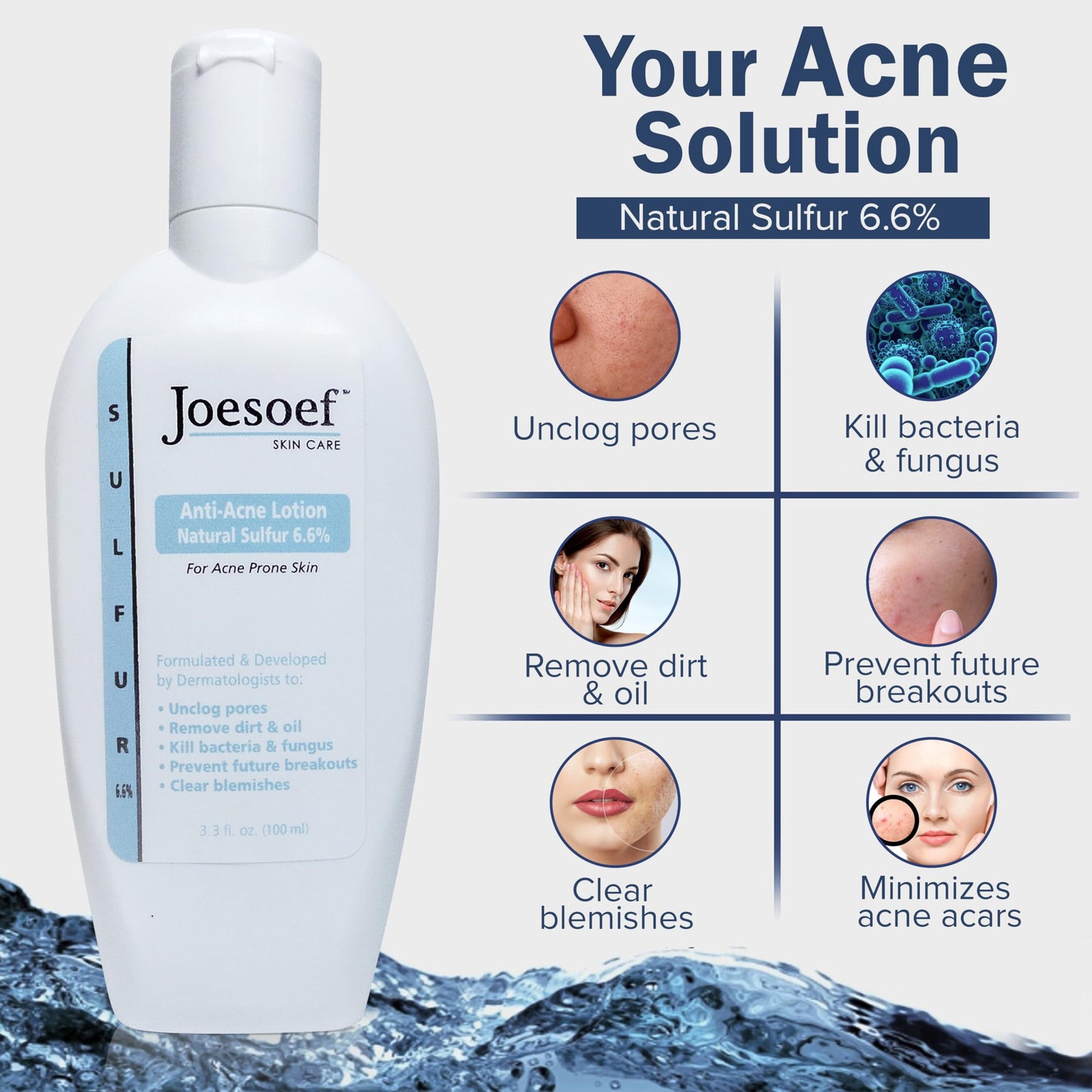 JOESOEF SKIN CARE Sulfur Soap for Acne Pharmaceutical Grade Dermatologists Approved for Acne Rosacea. Sulfur Acne Treatment for Skin Care Daily Routine. (2pack)