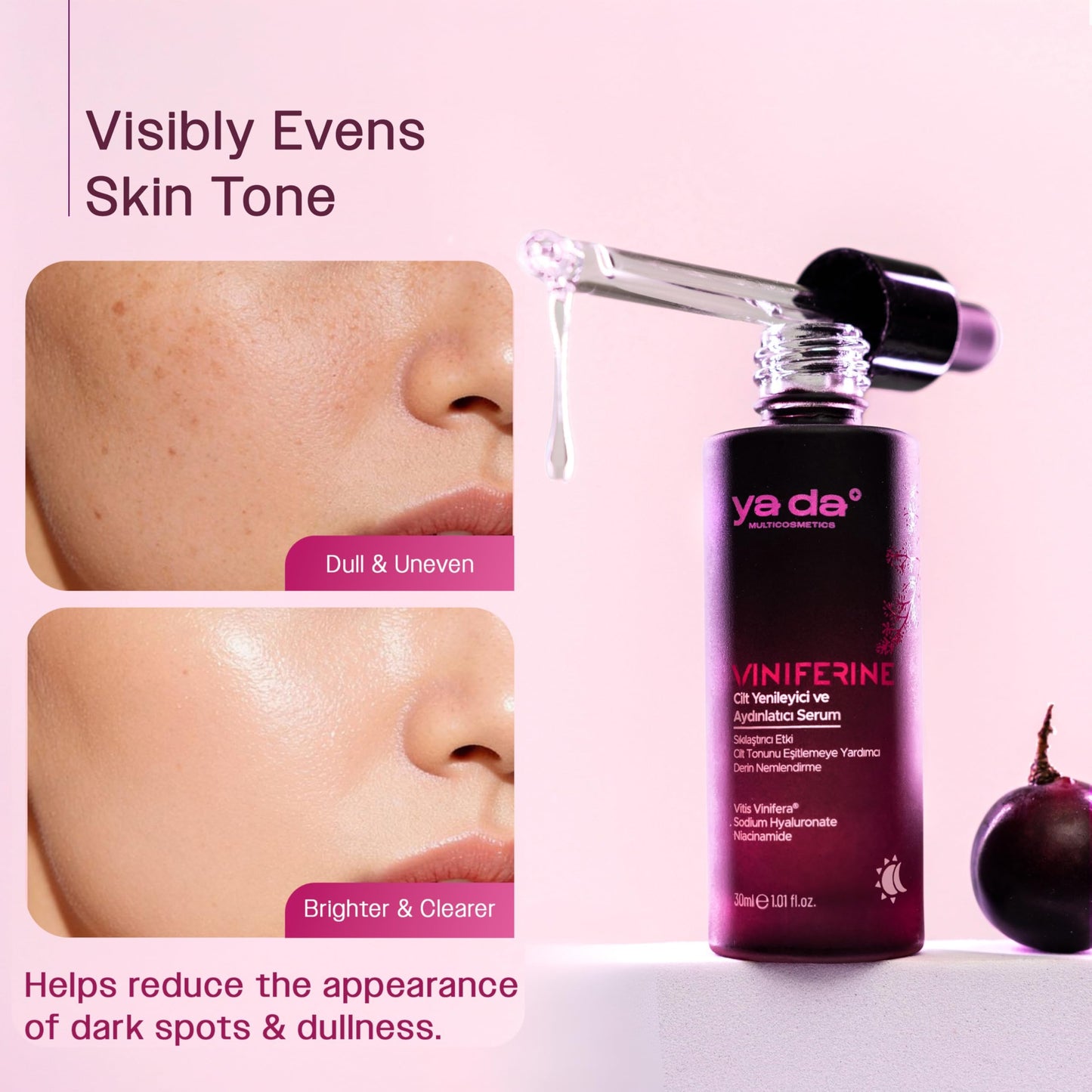 Dark Spot Remover for Face - Grape Extract Viniferine | Brightening Serum and Age Spot Remover | Clean Niacinamide Formula | Restores a Radiant Glow with Rejuvenating Hyperpigmentation Care | 1 Fl Oz