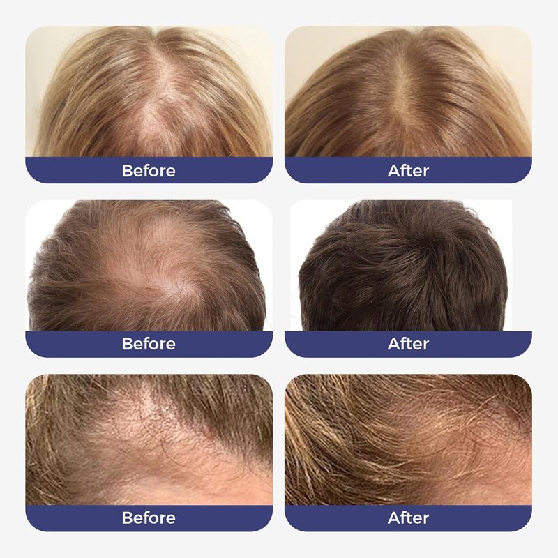 Hair Growth Serum Roll-On - 3% Rosemary & 6% Batana Oil | Fast-Absorbing Solution for Thinning Hair (2 Pcs)