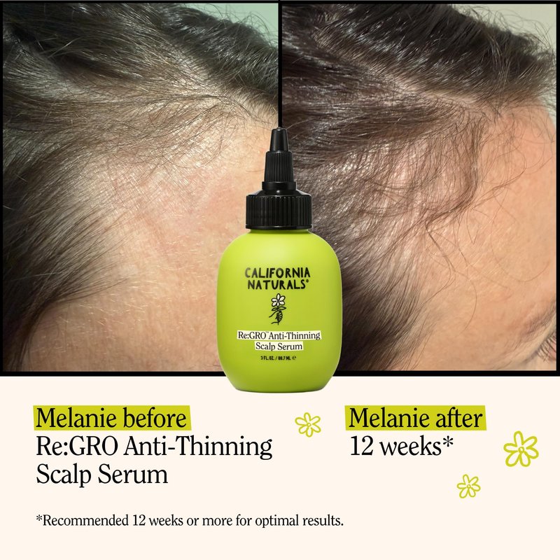 California Naturals Women's Re:GRO Anti-Thinning Scalp Serum, 5% Capixyl with Biotin, Caffeine & Castor and Rosemary Oil, Non-Sticky Cooling Formula, Vegan & Cruelty Free, 3oz