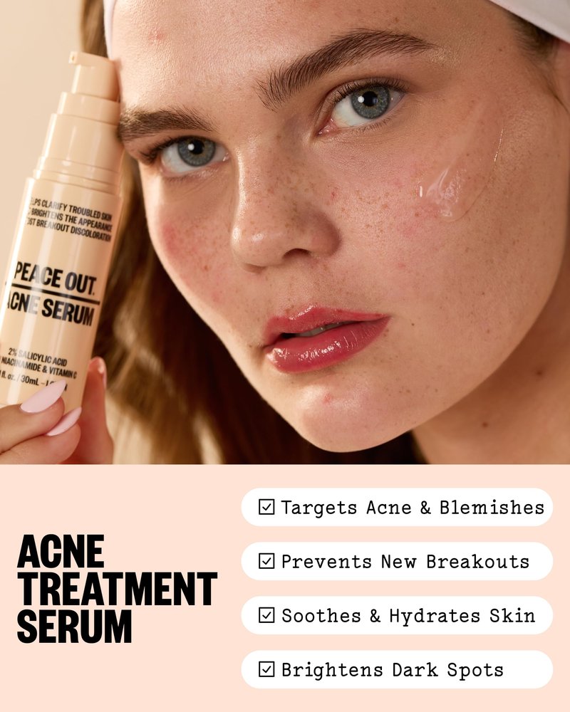 PEACE OUT Acne Serum with 2% Salicylic Acid and Niacinamide, Daily Acne Face Treatment to Help Unclog Pores, Reduce Pimple Breakouts, Blackheads, and Improve Skin Texture (1 fl oz)