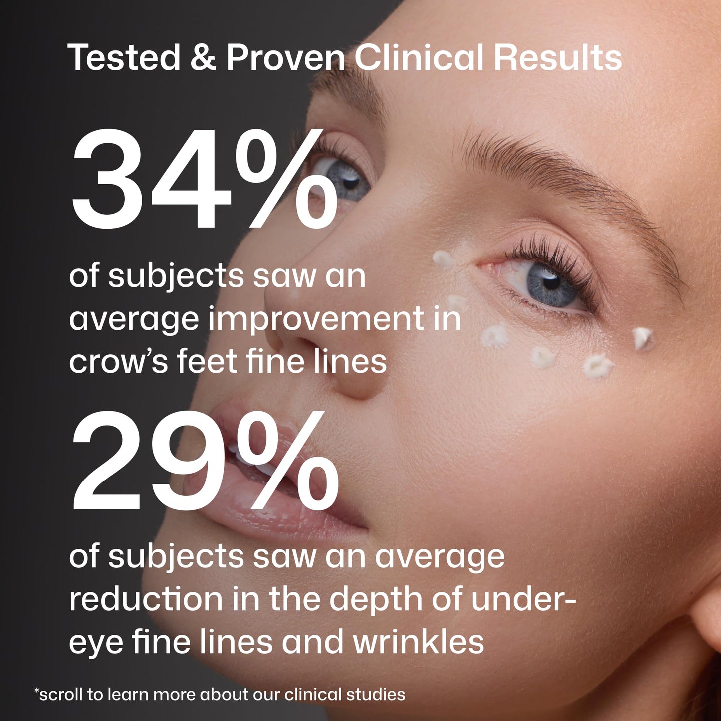 Revision Skincare D·E·J Eye Cream®, Clinically Proven to Reduce Under-Eye Fine Lines and Wrinkles with Peptides and Hyaluronic Acid for a Firmer, Smoother Eye Area, 0.5 fl oz