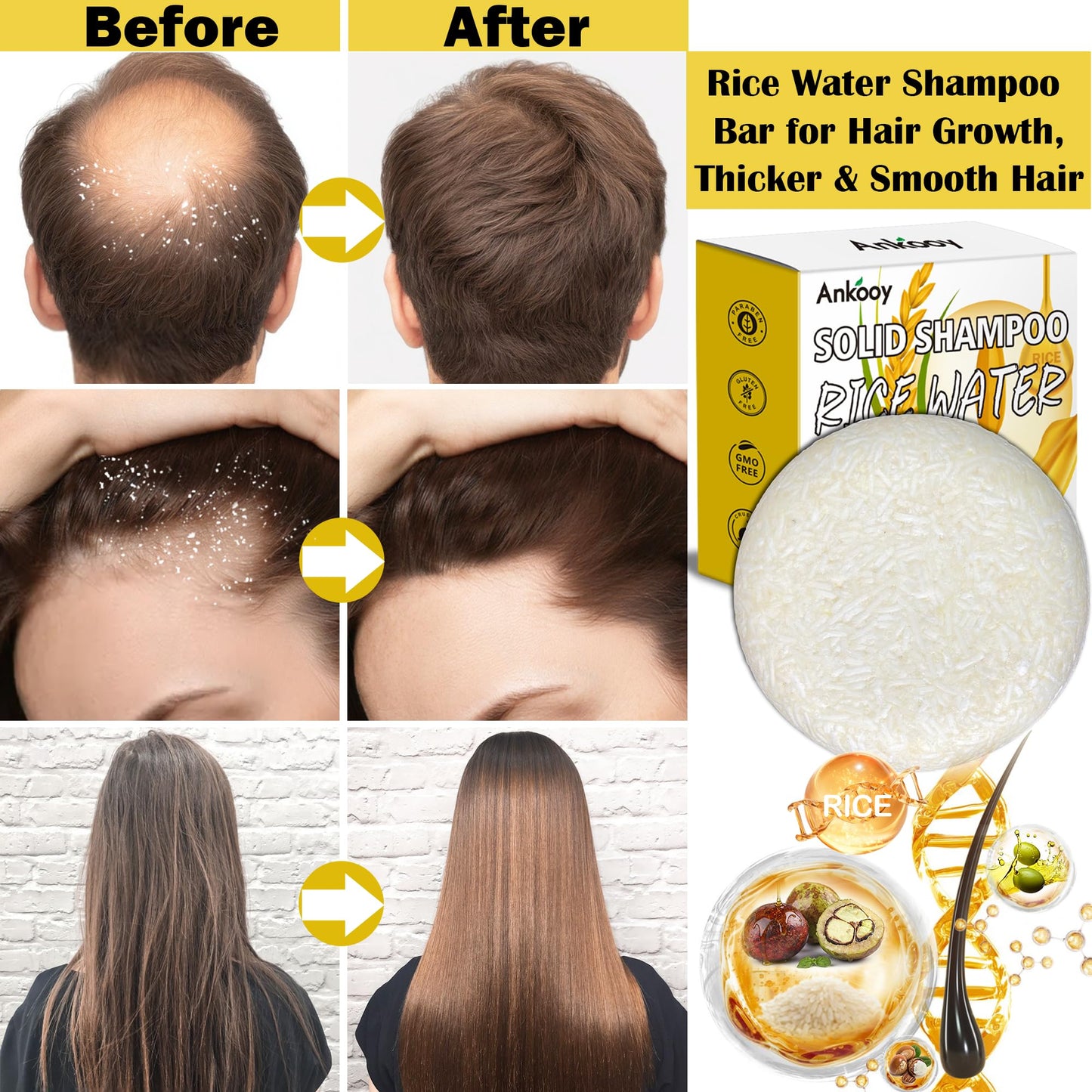 Shampoo Bar,Rice Water for Hair Growth,Clarifying Shampoo for Build Up,Soap Bar,Shampoo for Thinning Hair for Women and Men,Dandruff Shampoo,Frizz Control Hair Care,Travel Shampoo,Sulfate-Free(2 Pack)