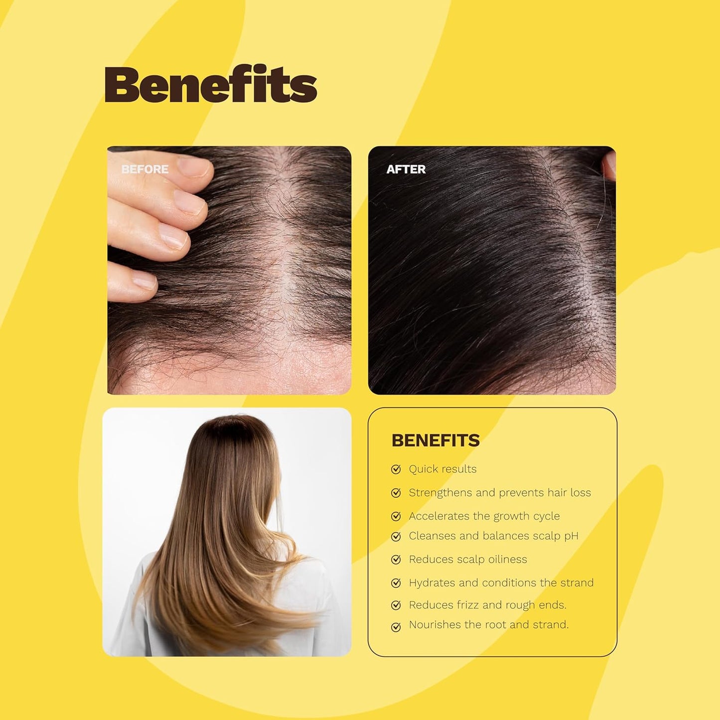 Ginger Milk SOS Hair Growth Kit - Vegan Hair Care Set with Biotin, Serum, Shampoo, & Nourishing Mask | Strengthens Roots & Reduces Hair Loss