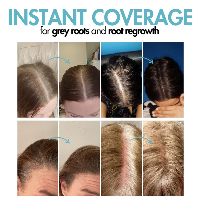 Hair Genetics Root Cover Up Hide Your Grey Hairs Roots NEW Mineral Powder Technology Natural looking Results in Seconds Root Touch Up Powder (Dark Brown)