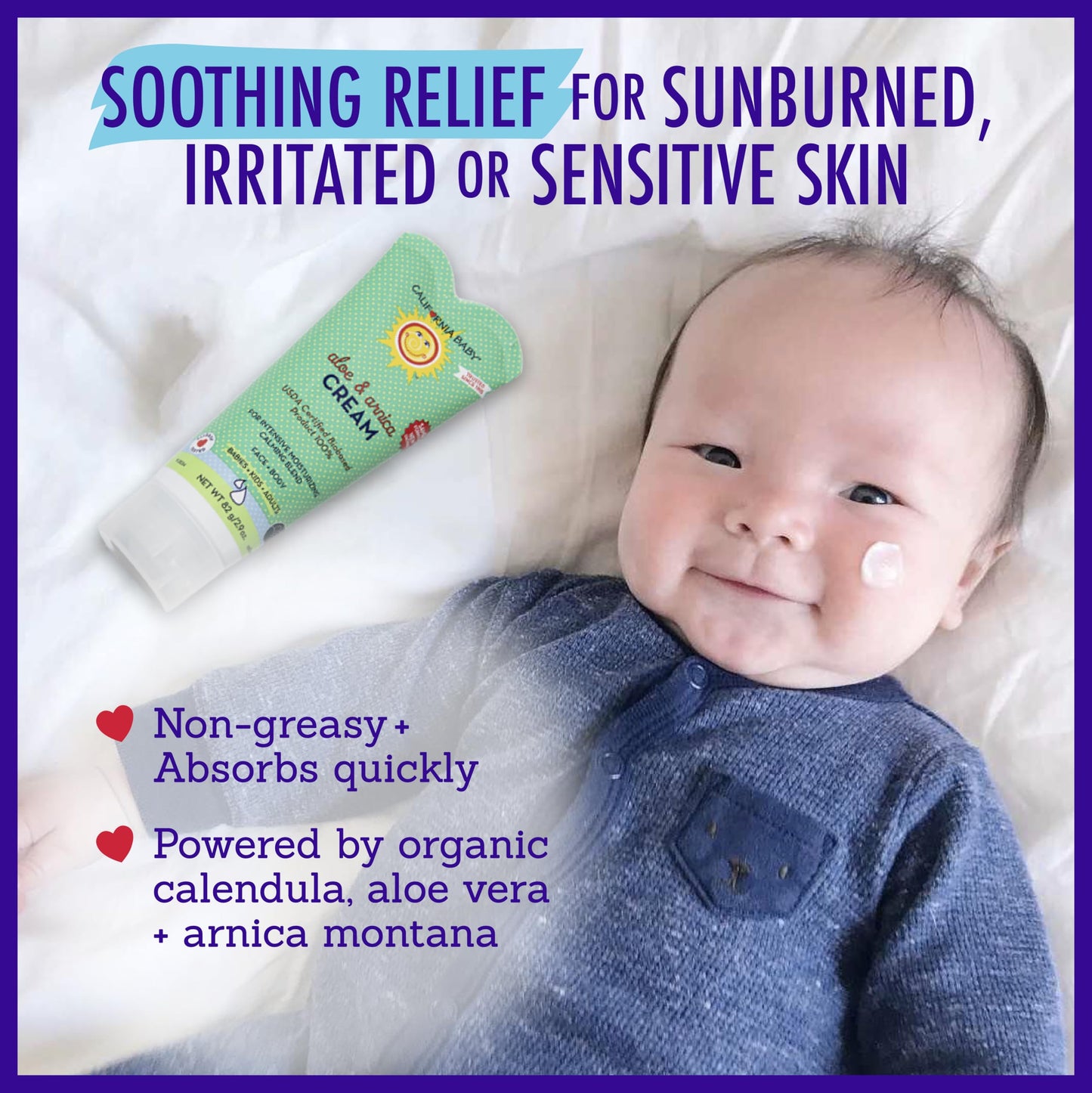 California Baby Aloe Vera & Arnica Cream | Soothing After Sun Lotion | 100% Plant-Based Sunburn Relief | Moisturizes Irritated Skin | 82 g / 2.9 oz.