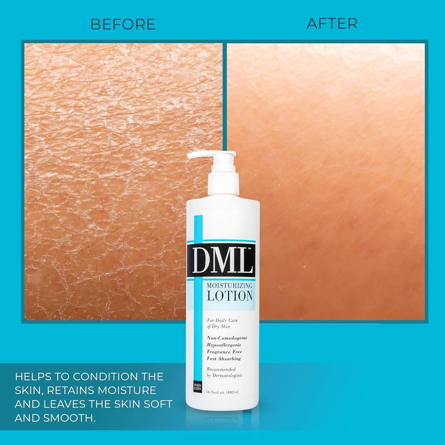 Moisturizing Lotion - Hydrating Skin Care Formula | 16 Fl Oz