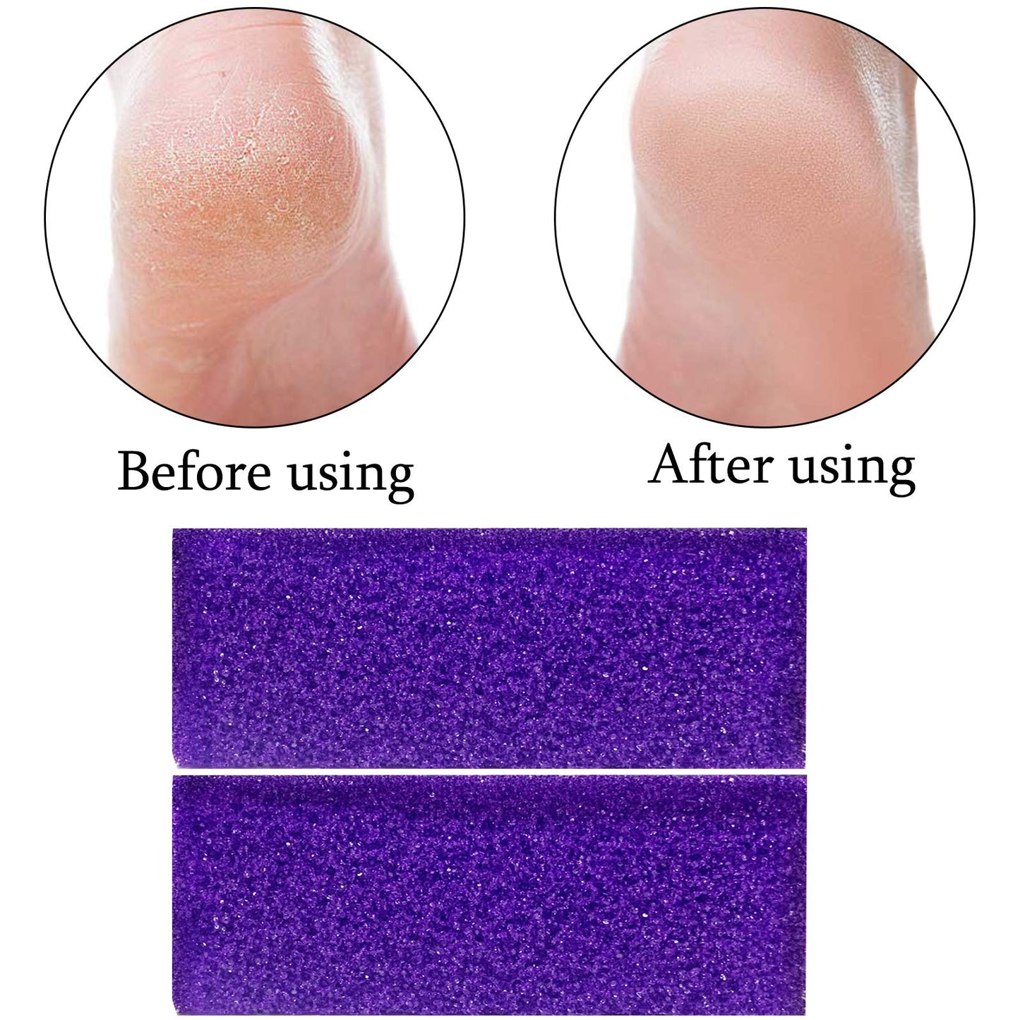 Tailpa 40 Pcs Pumice Stone for Feet, Foot Scrubber Sponge, Purple