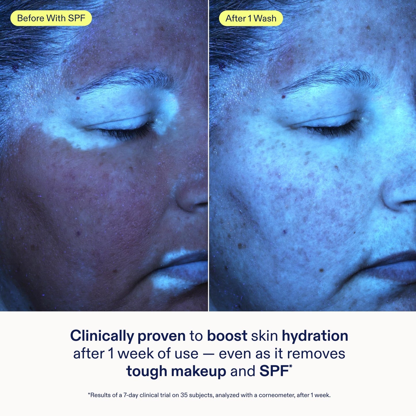 Skinfix Ceramide + Ectoin Gentle Gel Cleanser - 5 oz - SPF + Makeup Remover - Hydrates Skin - Vegan, Cruelty Free