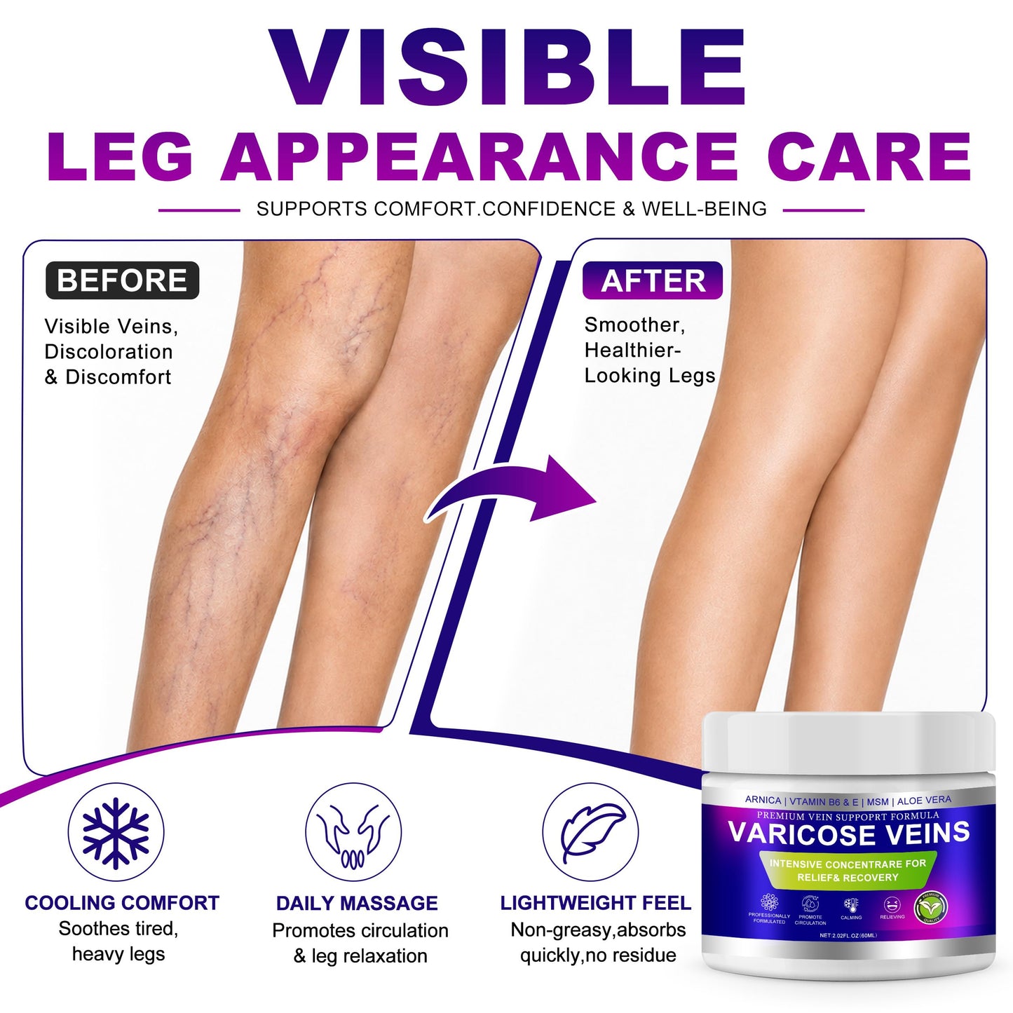 Varicose Veins Cream for Legs, Vein Cream for Spider Veins Appearance, Arnica Leg Cream with Aloe Vera, Non-Sticky Moisturizer for Tired Heavy Legs, Refreshing Daily Leg Care, （3 Pack, Blue)
