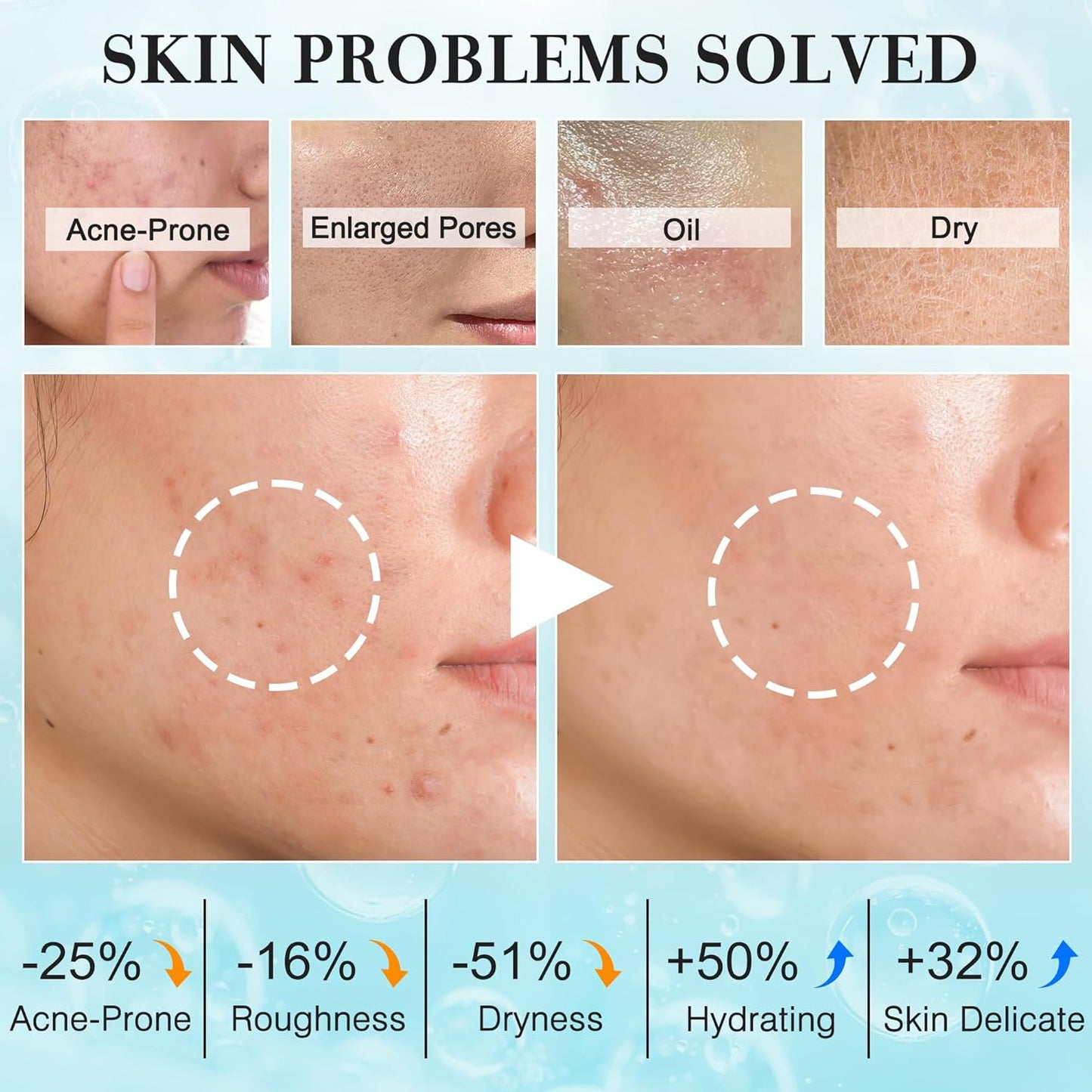 Hydrating Skincare Routine Kit for Teen Girls | Oil Control & Pore Shrinking Travel Size Gift Set