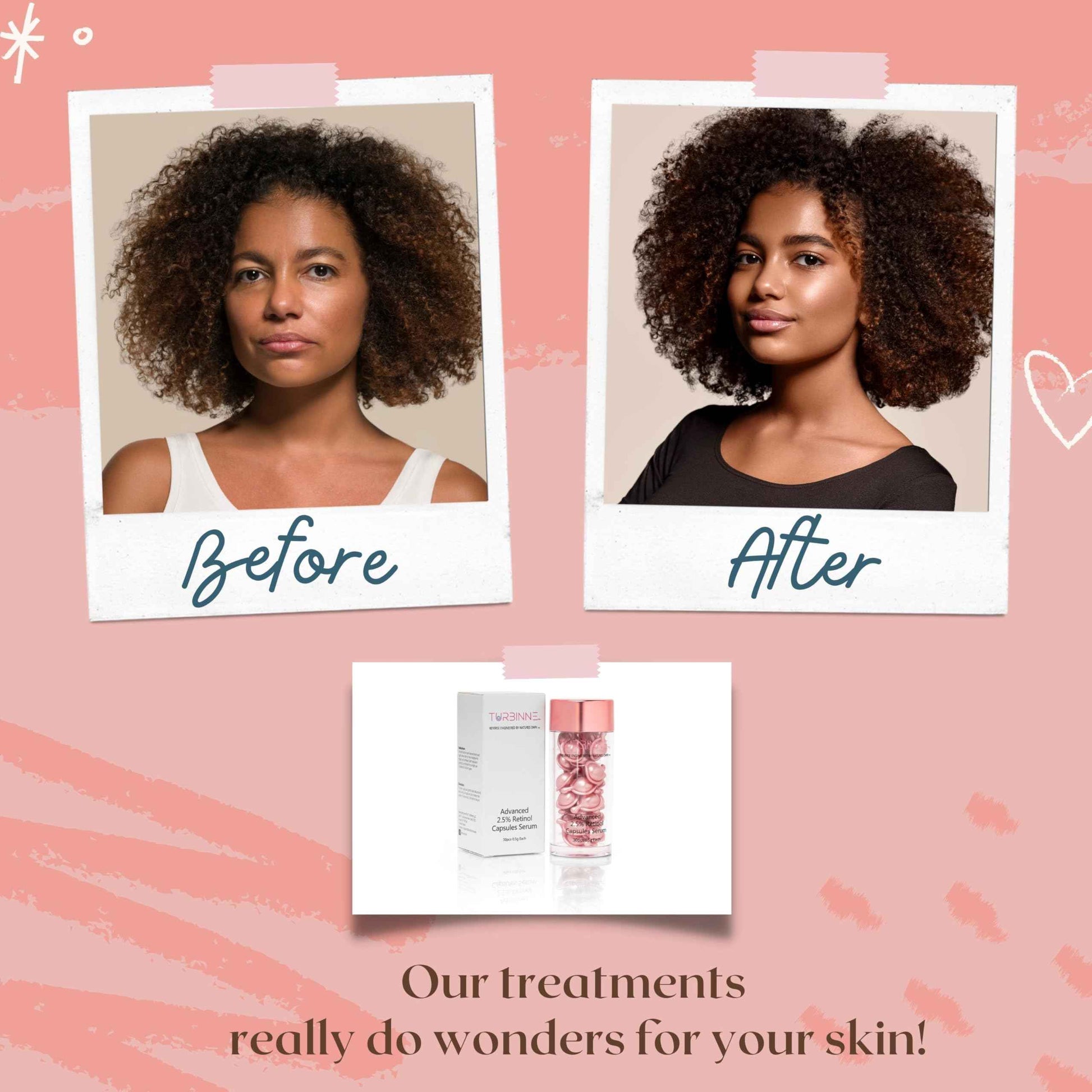 TURBINNE Pure 2.5% Retinol Serum Capsules. Look 5 Years Younger In Just 30 Days. Powerful Anti -Aging, Deep Hydration, Brightening, Reduce Wrinkles, Acne Scars, Dark Spots. Complete Skincare Capsules