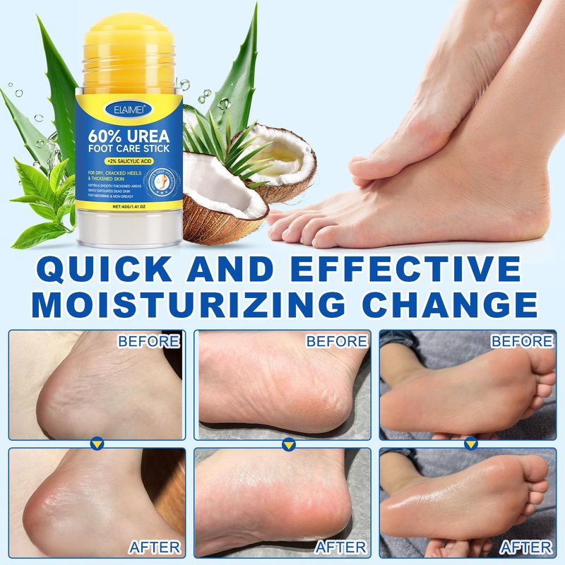 ConfidMiss Foot Care Stick with 60% Urea 2% Salicylic Acid Aloe Vera coconut tea tree oil, Foot Callus Dead Hard Skin Remover Moisturizer for Rough Dry Cracked Feet, Knees, Elbows, Hands Repair Stick