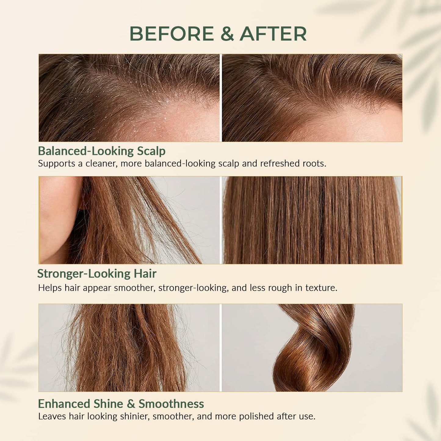 SPAVED Onion Hair Oil for Hair Growth 6.76 fl oz - Rosemary, Tea Tree, Argan & Jojoba Oil for Dry Itchy Scalp & Dandruff Care - Strengthening Nourishing Oil for Frizzy, Stronger Shinier-Looking Hair