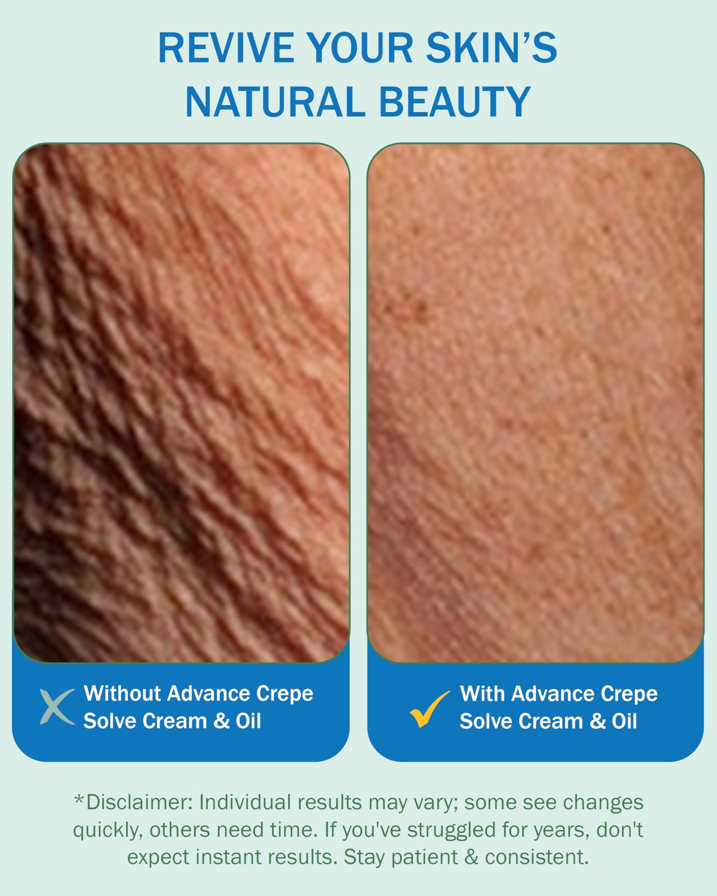 e70 Crepe Skin Erase Cream & Firming Oil Set (2 Pk, 4 Fl Oz each) - with Natural Oils, Licorice Root & Chamomile Extract - Crepey Skin Tightening and Firming Body Cream & Oil, Made in USA