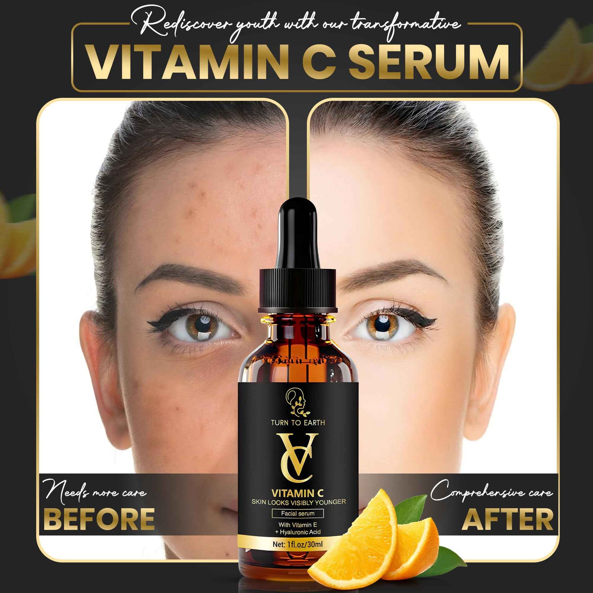 TURN TO EARTH Vitamin C Facial Serum with Vitamin E, Hyaluronic Acid, and Aloe Vera, for Skin Brightening, Dark Spot Reducing, Evening Skin Tone Formula in a 1 fl oz Glass Bottle