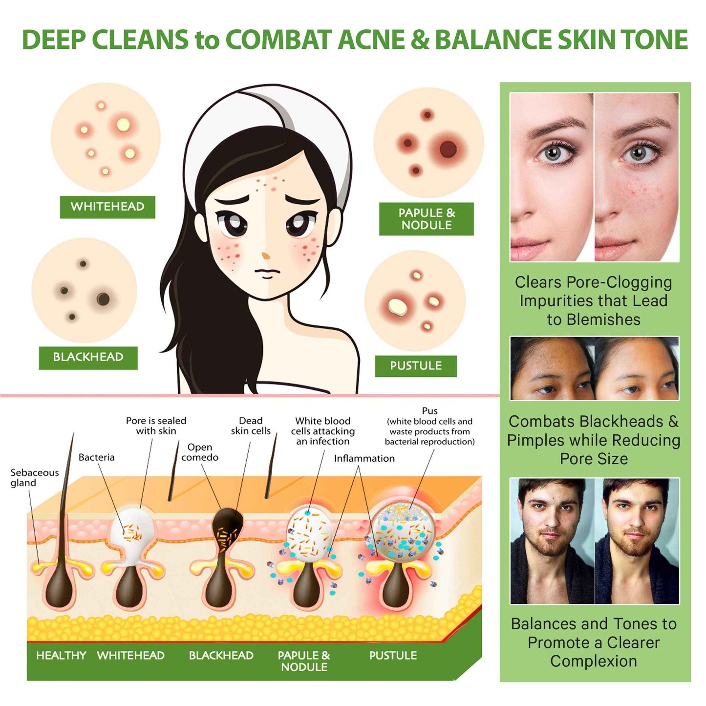 LILY SADO Rose Berry Pink Clay Mask w Rose Water & Fresh Berries - White Tea & Jojoba Beads Gently Exfoliate, Balance & Purify to Prevent Acne & Blackheads - 4 oz