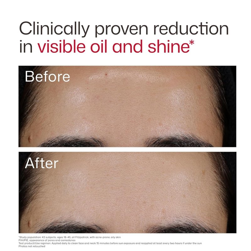 EltaMD UV Clear Sunscreen SPF 50 - Non-Comedogenic, Oil Balancing Formula for Blemish-Prone Skin