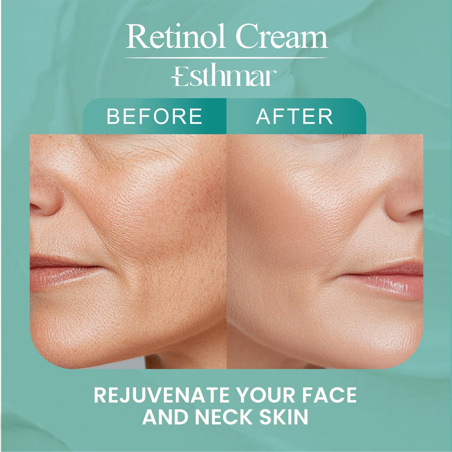 ESTHMAR Retinol Face & Neck Cream – Anti-Aging Night Moisturizer with Hyaluronic Acid, Vitamin E & Aloe Vera – Reduces Wrinkles, Fine Lines & Dark Spots, Hydrating for All Skin Types