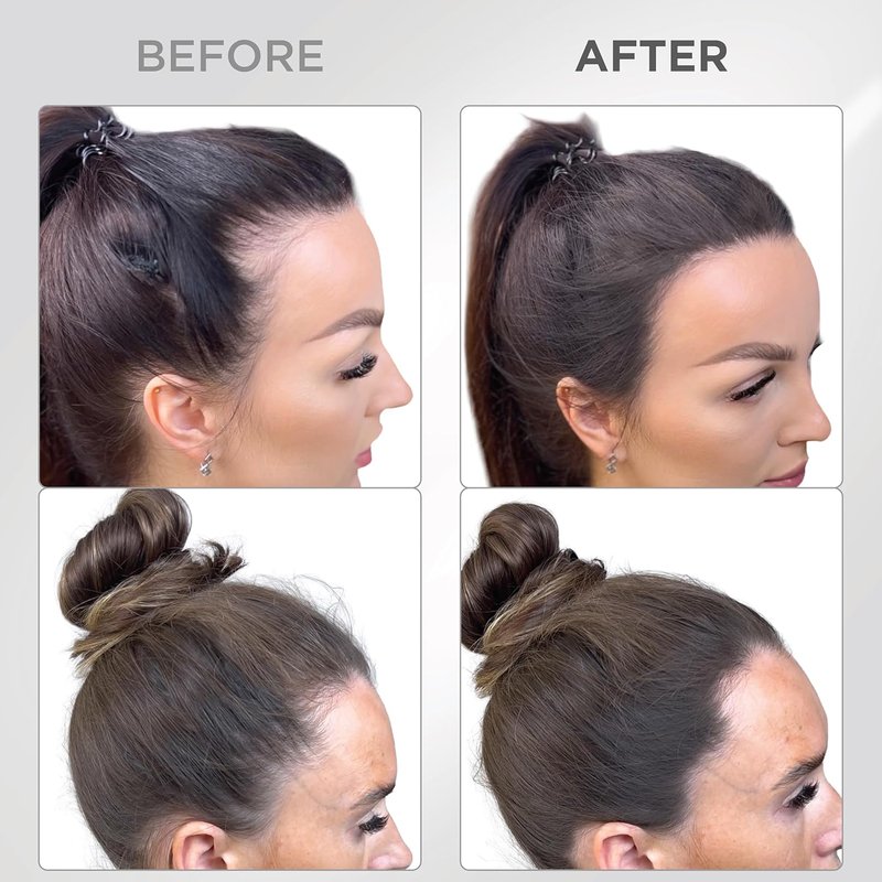Root Touch Up Powder - Water & Sweat Resistant Hair Loss Concealer for Thinning Hair | Dark Brown, Includes Brush