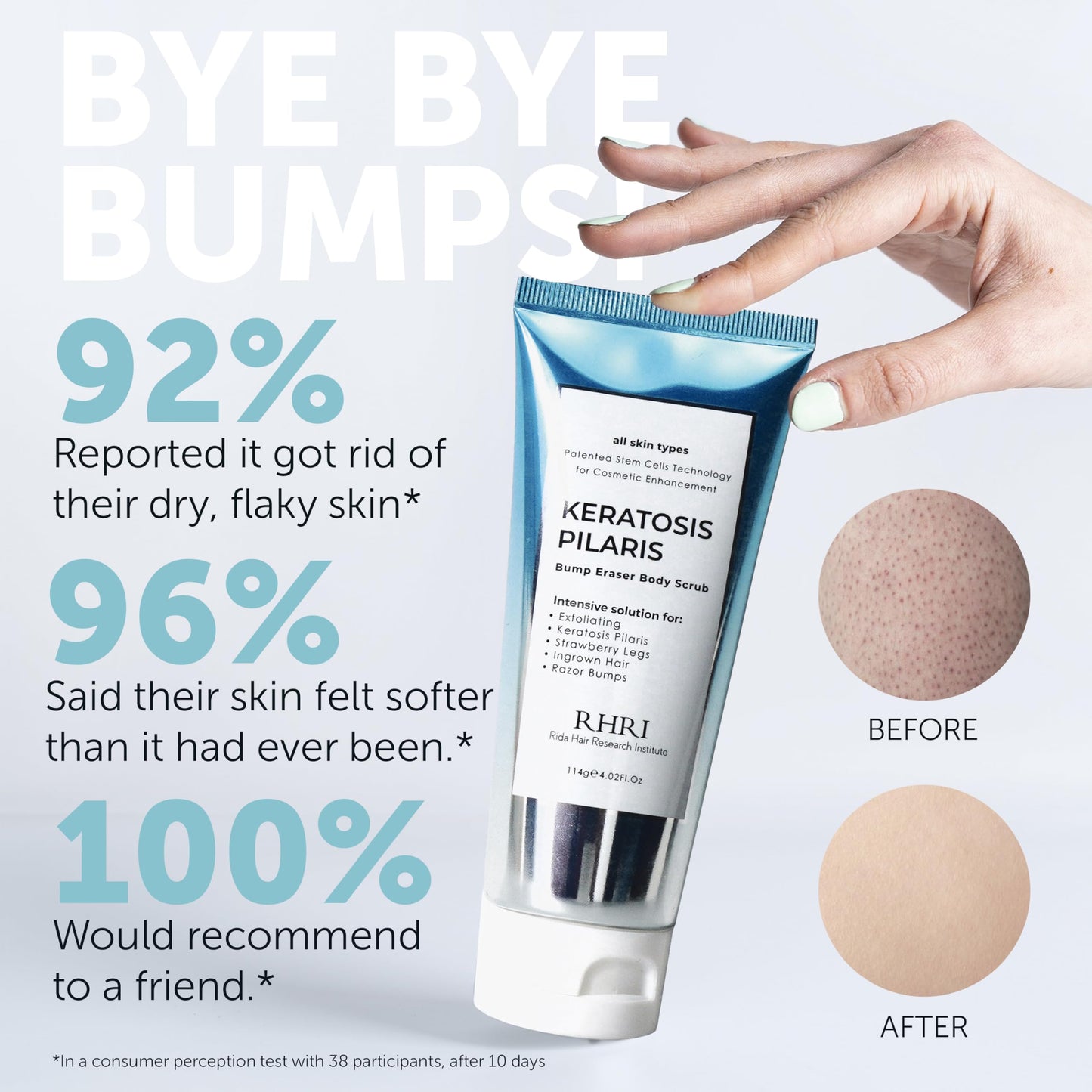 KP Bump Eraser Body Scrub with 10% AHA | Keratosis Pilaris Treatment | Bump Eraser Body Scrub | Clears Strawberry Legs | Soothes Redness, Dryness & Flaky Skin