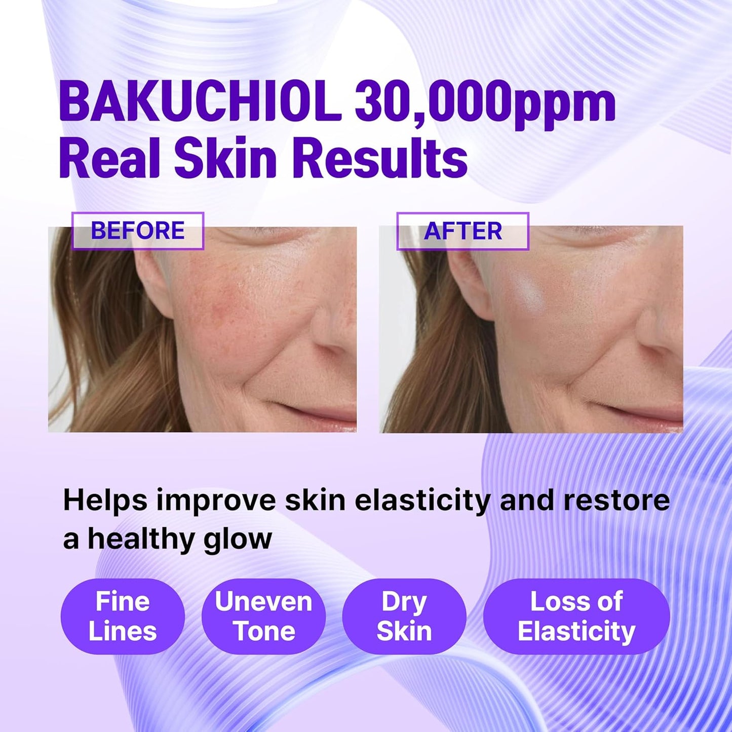 **CELDYQUE 100% Pure Volufiline & Bakuchiol Serum - High Potency Anti-Wrinkle Solution for Mature Skin | 30,000 ppm Concentrate**