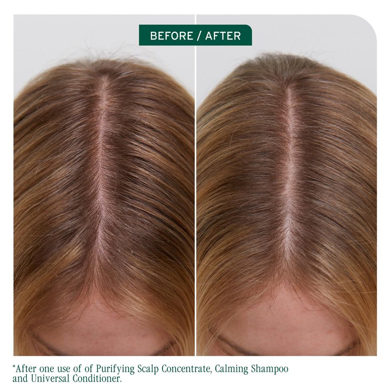 Biolage Scalp Sync Universal Conditioner - Nourishing & Hydrating for All Scalp Types, Lightweight Moisturizing & Conditioning, Fermented Tea Blend & Glycolic Acid, Vegan & Paraben-Free, 33.8 Fl Oz