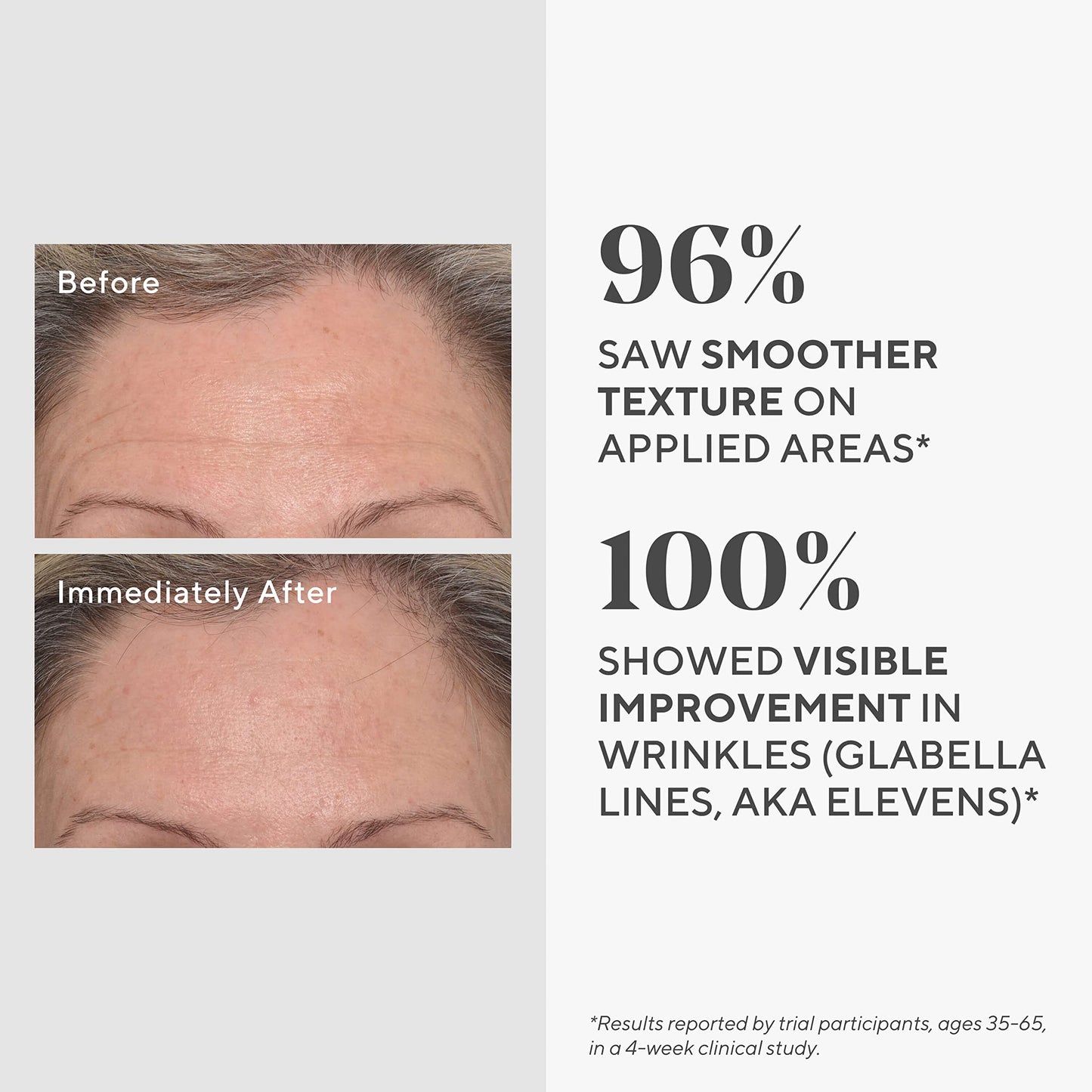 Murad Targeted Wrinkle Corrector - Hyaluronic Acid & Peptides - 0.5 Fl Oz