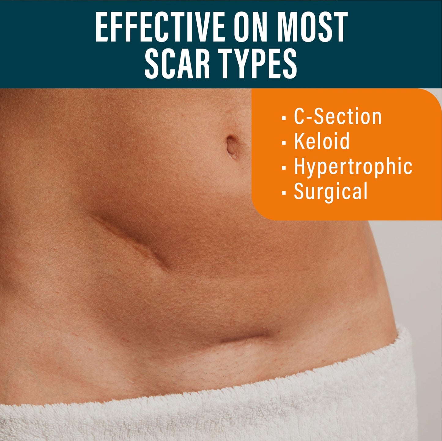 NUVADERMIS Silicone Scar Sheets - Extra Long Scar Sheets for C-Section, Tummy Tuck, Keloid, and Surgical Scars - Reusable Medical Grade Silicone Scar Sheets - 2 Packs of 4 - Medium Tone
