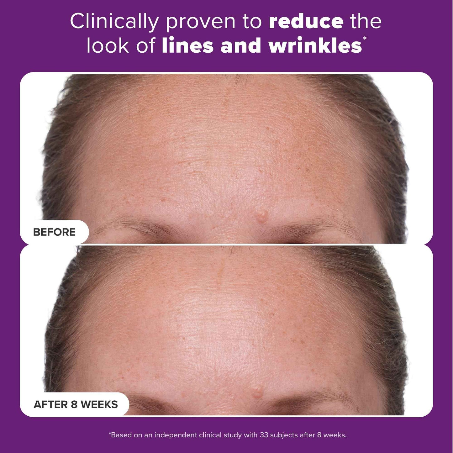 Paula's Choice CLINICAL 1% Retinol Treatment Cream with Peptides, Vitamin C & Licorice Extract, Anti-Aging & Wrinkles, Travel Size. PACKAGING MAY VARY.